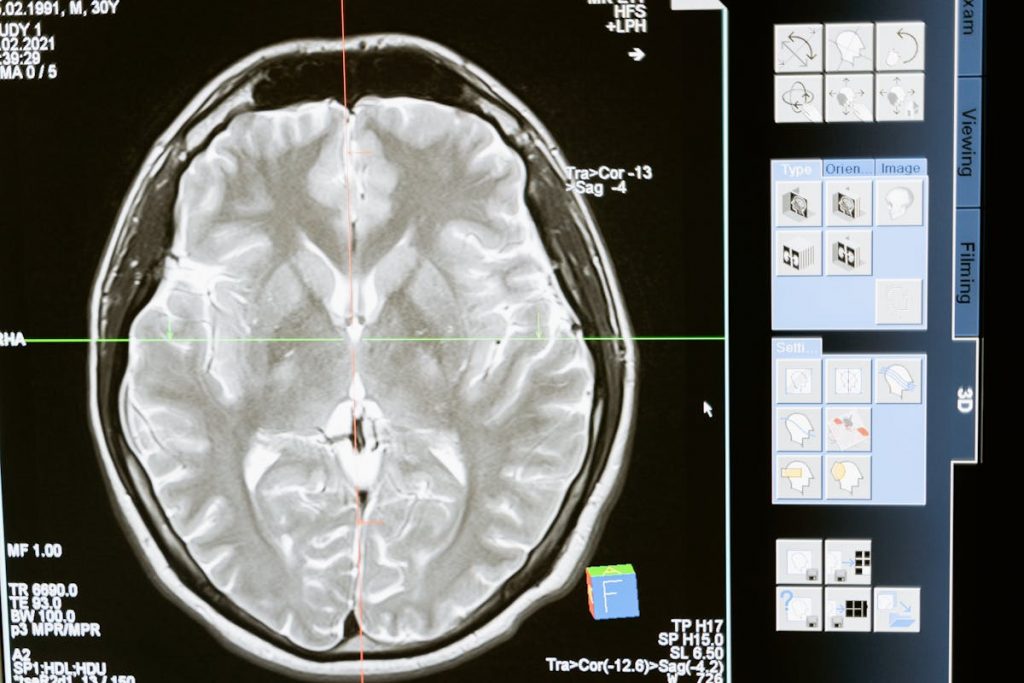 Medical brain scan on computer screen representing Japan healthcare data technology